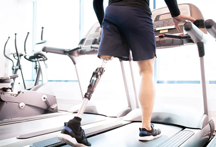 Leg amputee running on the treadmill with prosthetic